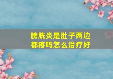 膀胱炎是肚子两边都疼吗怎么治疗好