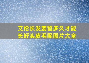 艾伦长发要留多久才能长好头皮毛呢图片大全