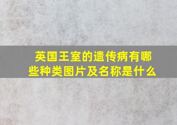 英国王室的遗传病有哪些种类图片及名称是什么