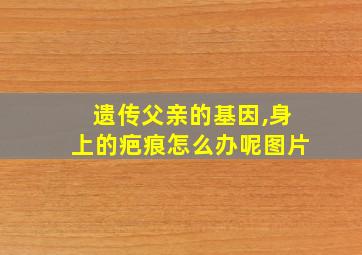 遗传父亲的基因,身上的疤痕怎么办呢图片