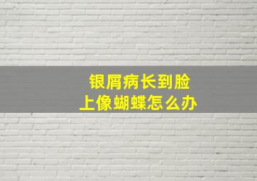 银屑病长到脸上像蝴蝶怎么办