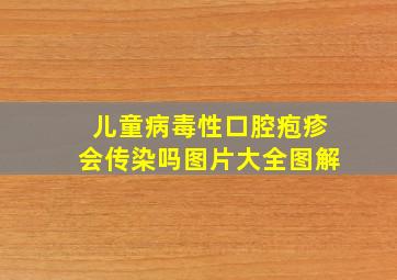 儿童病毒性口腔疱疹会传染吗图片大全图解