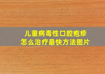 儿童病毒性口腔疱疹怎么治疗最快方法图片