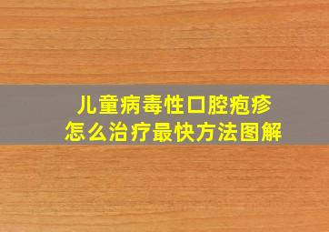 儿童病毒性口腔疱疹怎么治疗最快方法图解