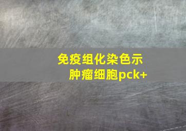 免疫组化染色示肿瘤细胞pck+