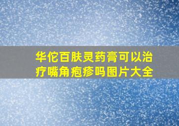 华佗百肤灵药膏可以治疗嘴角疱疹吗图片大全