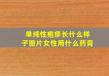 单纯性疱疹长什么样子图片女性用什么药膏