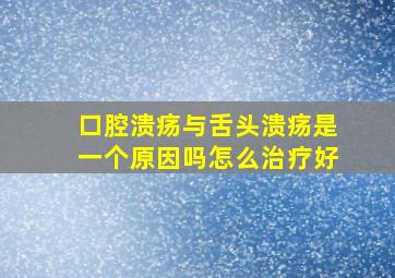 口腔溃疡与舌头溃疡是一个原因吗怎么治疗好