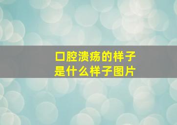 口腔溃疡的样子是什么样子图片