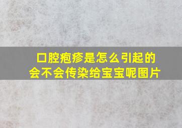 口腔疱疹是怎么引起的会不会传染给宝宝呢图片