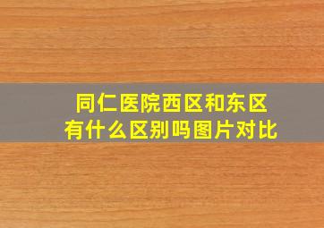 同仁医院西区和东区有什么区别吗图片对比