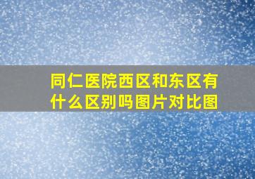 同仁医院西区和东区有什么区别吗图片对比图