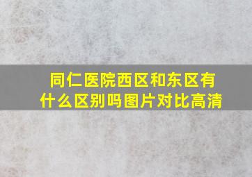 同仁医院西区和东区有什么区别吗图片对比高清