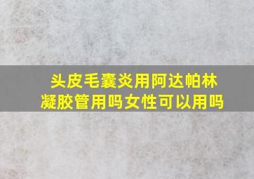 头皮毛囊炎用阿达帕林凝胶管用吗女性可以用吗