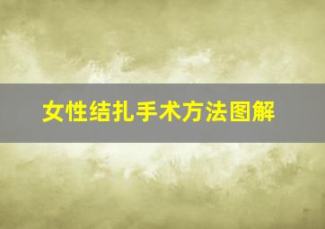 女性结扎手术方法图解