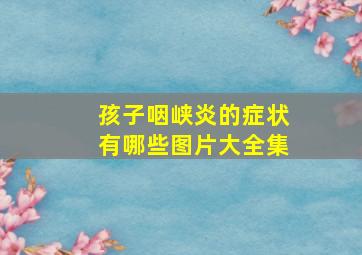 孩子咽峡炎的症状有哪些图片大全集