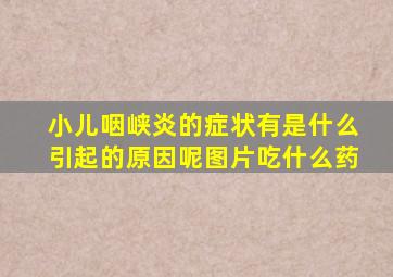 小儿咽峡炎的症状有是什么引起的原因呢图片吃什么药