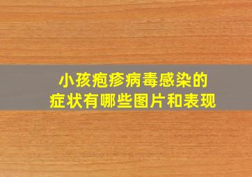 小孩疱疹病毒感染的症状有哪些图片和表现