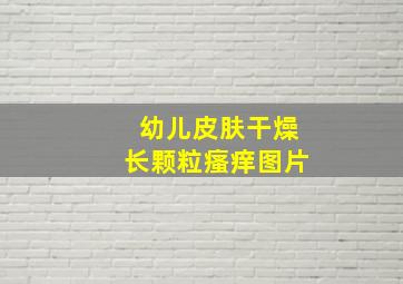 幼儿皮肤干燥长颗粒瘙痒图片