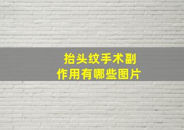 抬头纹手术副作用有哪些图片