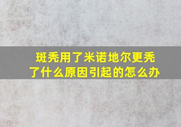 斑秃用了米诺地尔更秃了什么原因引起的怎么办