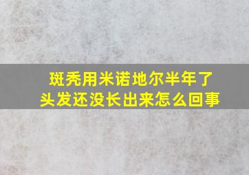 斑秃用米诺地尔半年了头发还没长出来怎么回事