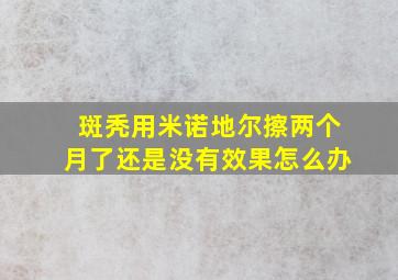 斑秃用米诺地尔擦两个月了还是没有效果怎么办