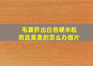 毛囊挤出白色硬米粒而且臭臭的怎么办图片