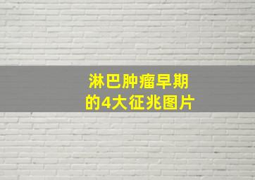 淋巴肿瘤早期的4大征兆图片