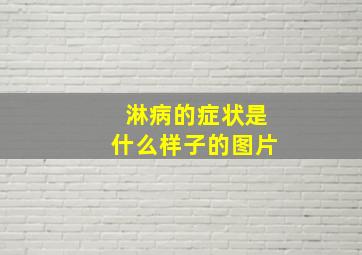 淋病的症状是什么样子的图片