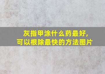 灰指甲涂什么药最好,可以根除最快的方法图片