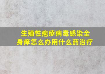 生殖性疱疹病毒感染全身痒怎么办用什么药治疗