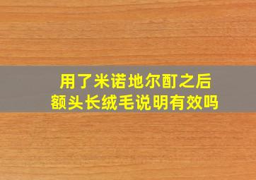 用了米诺地尔酊之后额头长绒毛说明有效吗