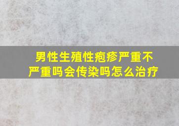 男性生殖性疱疹严重不严重吗会传染吗怎么治疗