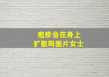 疱疹会在身上扩散吗图片女士