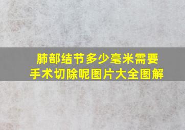 肺部结节多少毫米需要手术切除呢图片大全图解