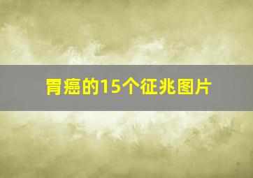 胃癌的15个征兆图片