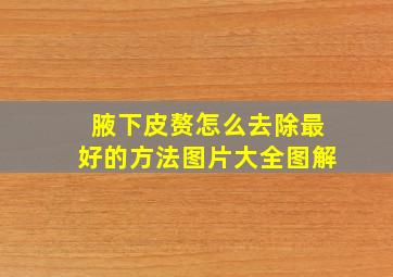 腋下皮赘怎么去除最好的方法图片大全图解