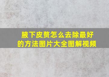 腋下皮赘怎么去除最好的方法图片大全图解视频