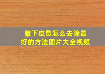 腋下皮赘怎么去除最好的方法图片大全视频