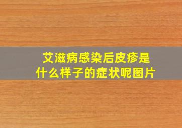 艾滋病感染后皮疹是什么样子的症状呢图片