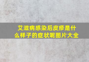 艾滋病感染后皮疹是什么样子的症状呢图片大全