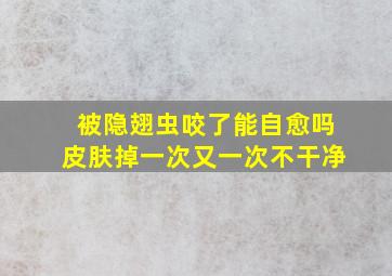 被隐翅虫咬了能自愈吗皮肤掉一次又一次不干净