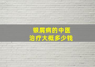 银屑病的中医治疗大概多少钱