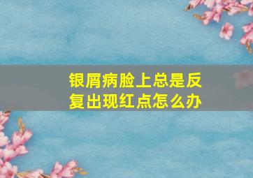 银屑病脸上总是反复出现红点怎么办