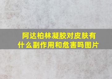 阿达柏林凝胶对皮肤有什么副作用和危害吗图片