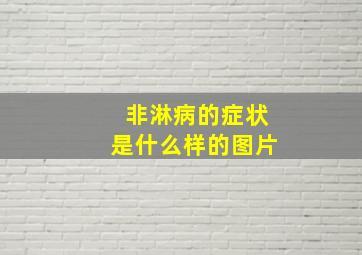 非淋病的症状是什么样的图片